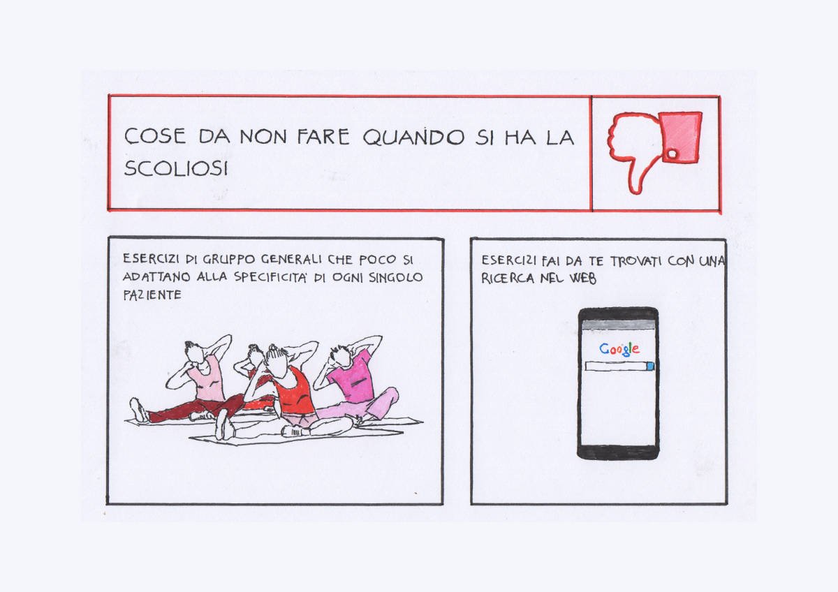 Trattamento della scoliosi: parte 2. Gli esercizi per la scoliosi.