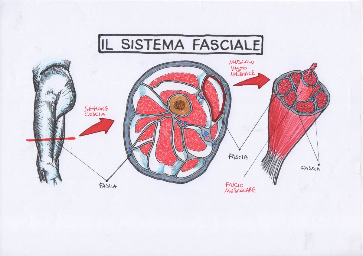 Cura della scoliosi tramite il sistema fasciale