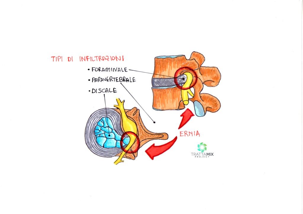 OSSIGENO OZONOTERAPIA COSTI e prezzi 2